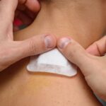 Explore the Health Advantages of Skin Patches for Nausea Management